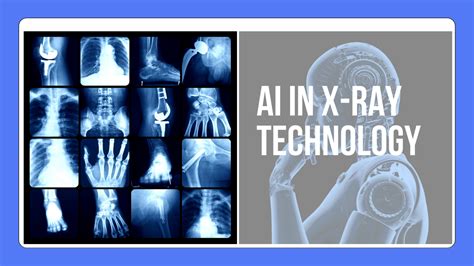 AI in X-Ray Technology: Can AI replace Rad Techs