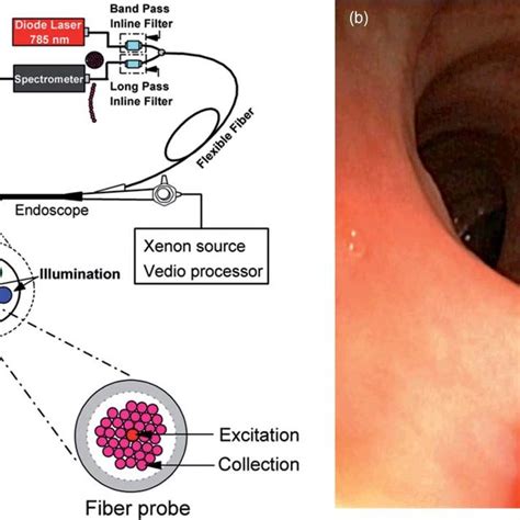 A Schematic Of The Integrated Autofluorescence Spectroscopy And