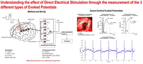 Presentation Brain Electrophysiological Mapping