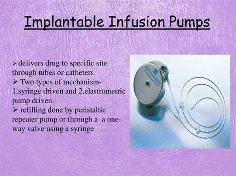 Implantable Polymer Based Drug Delivery System For Tailored Drug Rele…