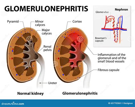 Kidney Anatomy Glomerulus