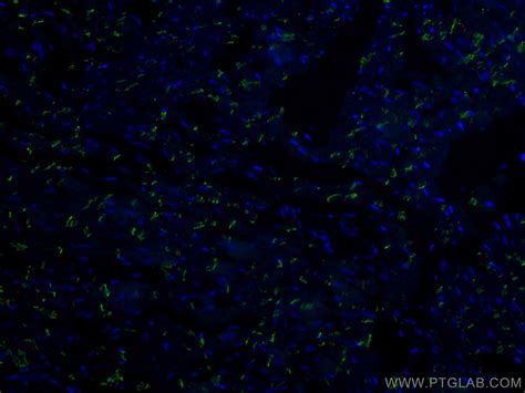 N Cadherin Antibody CL488 22018 Proteintech