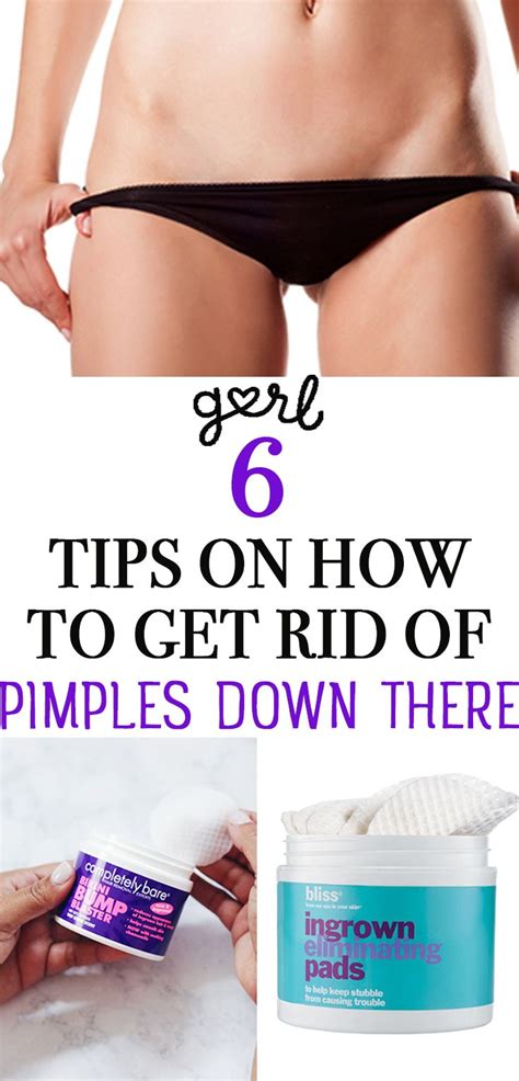 6 Tips On How To Get Rid Of Pimples Down There How To Get Rid Of Pimples Pimples Ingrown Pimple