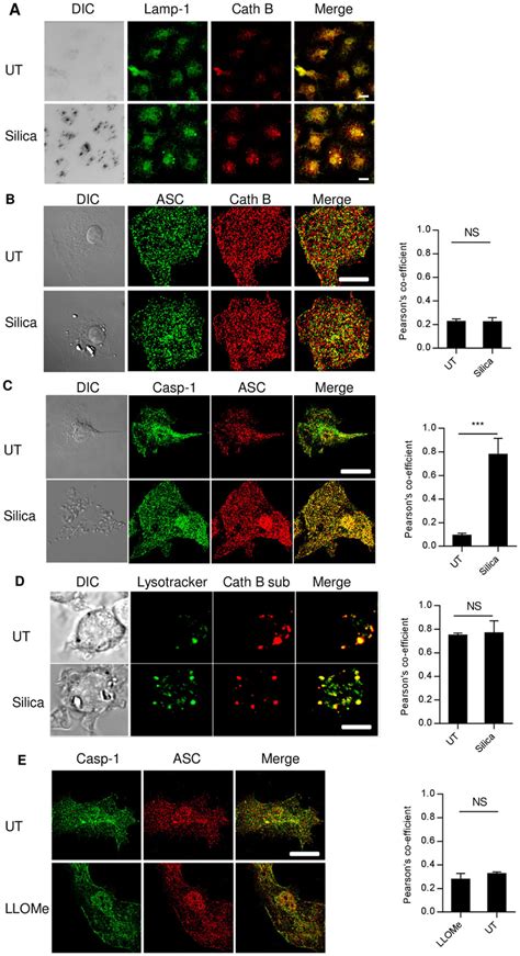 Lysosomal Damage Is Not Essential In Silica Mediated Nlrp Activation