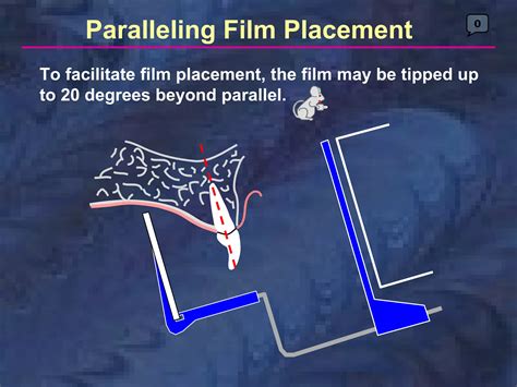 radiology-paralleling-technique | PDF