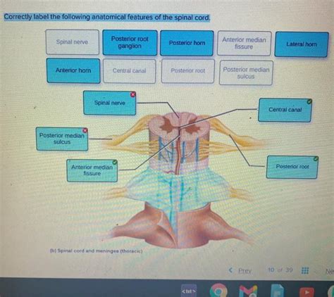 Correctly Label The Following Anatomical Features Of The Spinal Cord