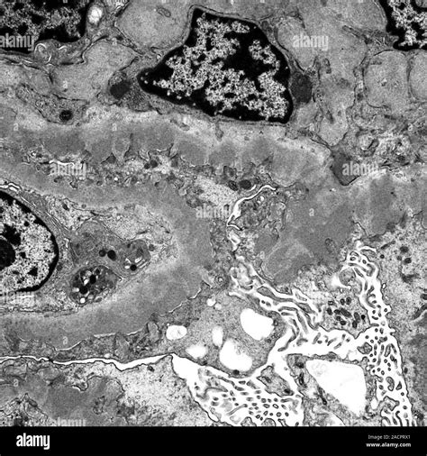 Intraglomerular Mesangial Cells Transmission Electron Micrograph Tem