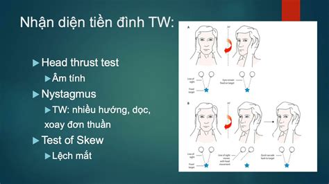 Tiếp cận Chẩn đoán Chóng mặt Ngoại biên và Trung ương YouTube