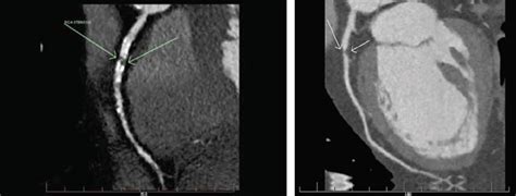 RACGP Imaging For Cardiac Disease A Practical Guide For General