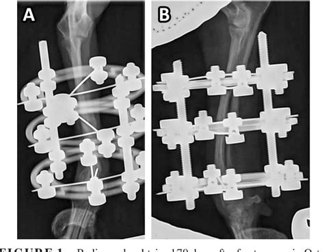 Figure 1 From Radius And Ulna Fracture Repair With The Imex Miniature