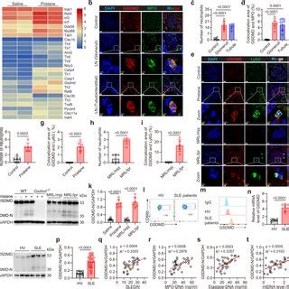 Gsdmd Inhibition Alleviates Disease Activity In Mrl Lpr Mice A Images