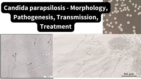 Candida Parapsilosis Morphology Pathogenesis Transmission