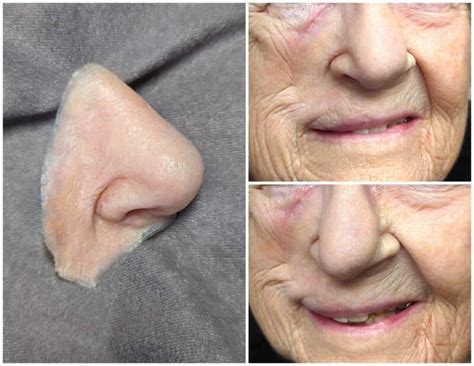 Prótese estética nasal lifelike Medical Art Prosthetics para adulto