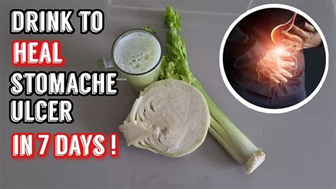 The Shocking Secret Of Cabbage Juice And Escape Ulcer Pain Naturally