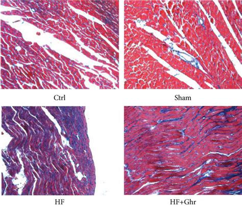 Masson Staining Pathological Imaging Results Of Myocardial Tissue Of Download Scientific