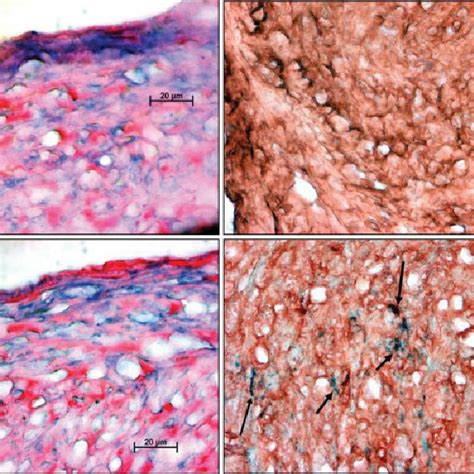 A Colony Forming Unit Granulocyte Macrophage Cfu Gm Differentiated Download Scientific