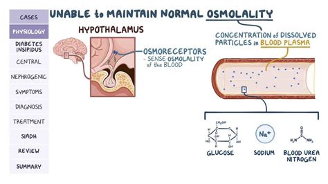 Diabetes Insipidus And Siadh Pathology Review Video Causes And Meaning Osmosis