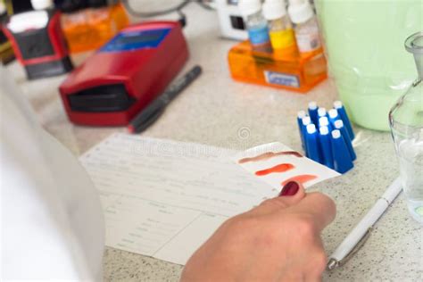 Blood type testing. stock image. Image of monitoring - 41105391