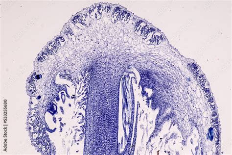 Plant tissue Structure, section (tissue) of stem plant tissue under a ...