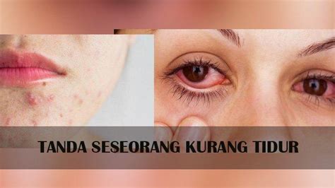 Tanda Seseorang Kurang Tidur Ini Yang Terjadi Pada Tubuh