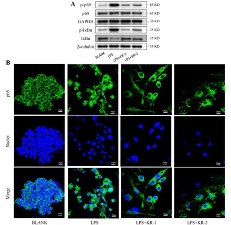 A Expression Levels Of Nf B Signaling Pathway Related Proteins P