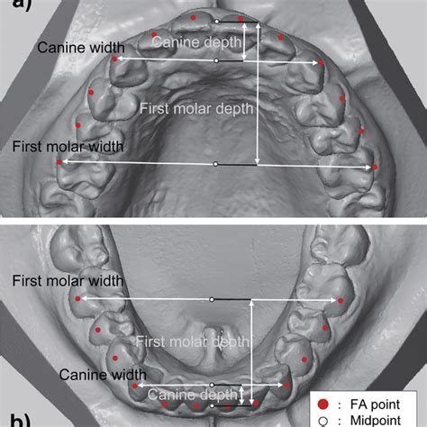 Dental Arch Dimensions A Maxillary Dental Cast B Mandibular