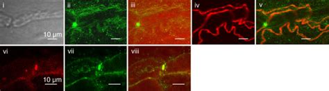 Immunohistochemistry Of Kv7 Channels In Human Sural Nerve Fascicles In