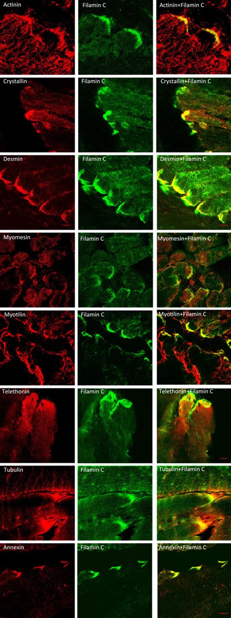 Immunostainings Of Selected Proteins From The MTJ Sample Longitudinal