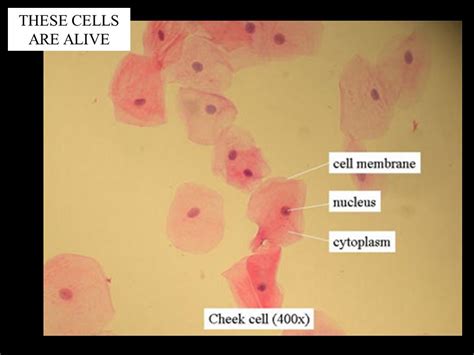 Cheek Cells Under Microscope Labeled