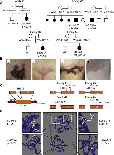 Identification Of Five Patients And Six Different Mutations Of Isg