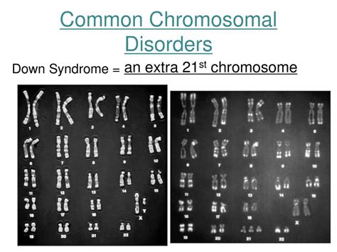 Chromosomal Disorders Ppt Download