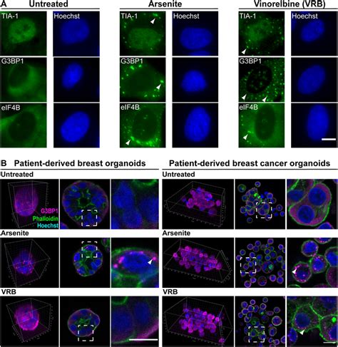 VRB Induces SG Formation In Cells And Organoids A SG Markers TIA 1