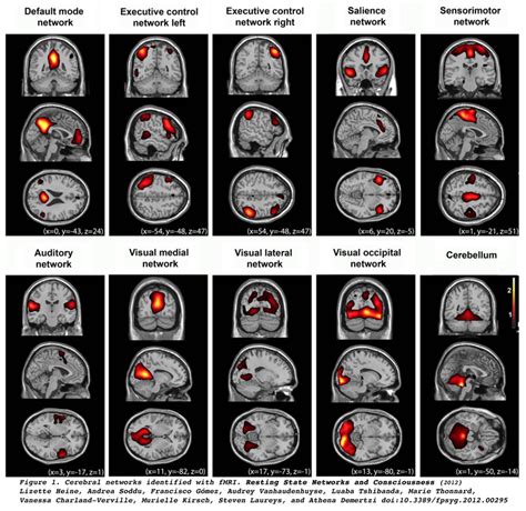 Magnetism Questions And Answers In Mri