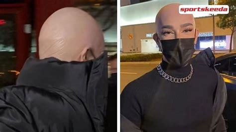 Twitter user tries to expose James Charles for fake bald look, claims it's just a bald cap