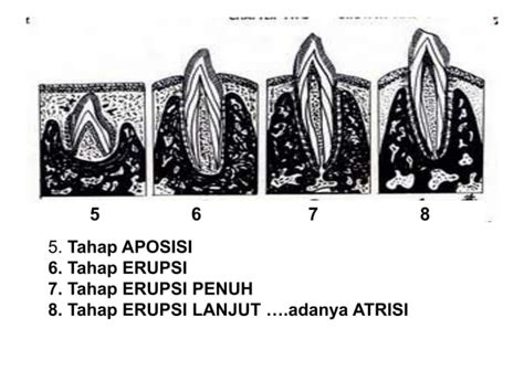 Pertumbuhan Gigi Ppt