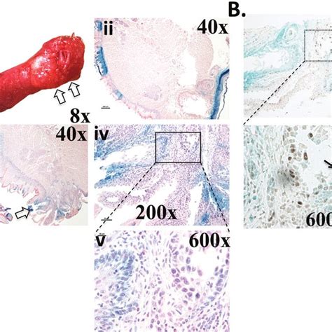 The Carcinogen 4 Nqo Reduces The Numbers Of X Gal Cell Populations Download Scientific