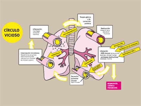 Fibrosis Quística Fundación Lovexair