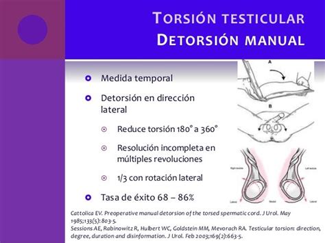 Testicular Torsion Reduction