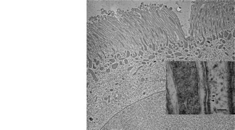 Gastric caeca: electron micrograph of an epithelial cell. 'Stretched'... | Download Scientific ...