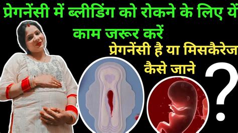 🤱pregnancy Me Bleeding🩸hui Hai To Ye 5 Galti Kabhi Mat Karnaप्रेगनेंसी