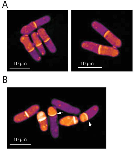 Figures And Data In Variations Of Intracellular Density During The Cell