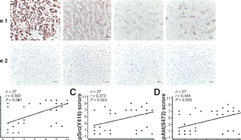 Lhbs Expression Positively Correlates With Increased Ki Psrc Y