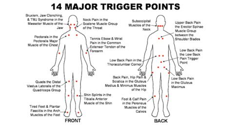 Cervical Pain Icd 10