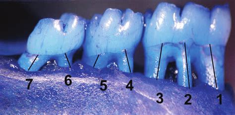 Photograph Of The Periodontal Bone Loss Pbl Morphometrically Assessed