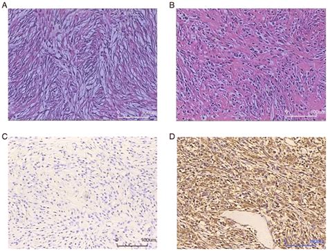 Hematoxylin And Eosin Staining And Immunohistochemistry A