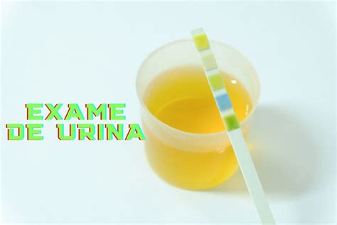 Exame De Urina Tem Que Ser A Primeira Do Dia - Por que exame de urina tem que ser o primeiro jato da manhã?