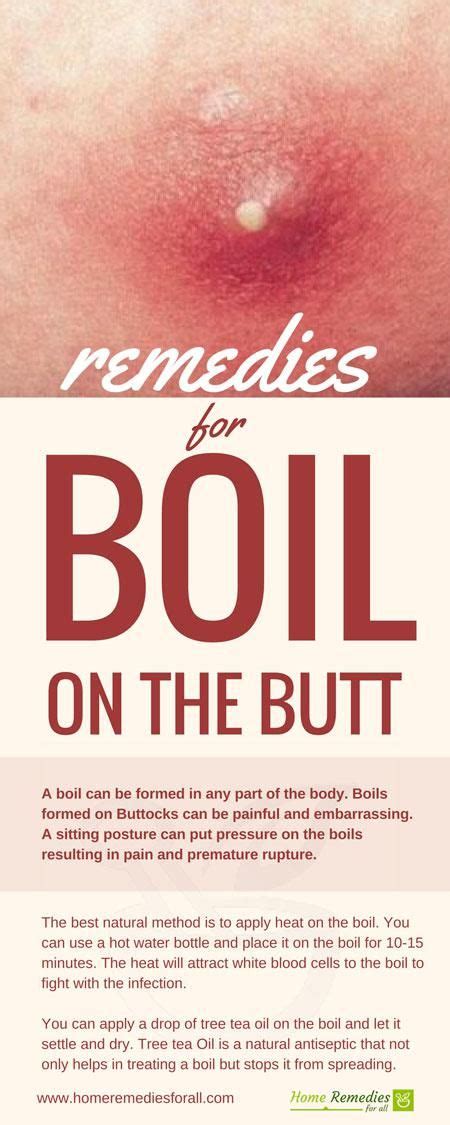 9 Boils remedies ideas | boil remedies, remedies, boil