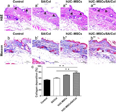 Sacol Hydrogel Loaded With Huc Mscs Promoted Tissue Remodeling Hande