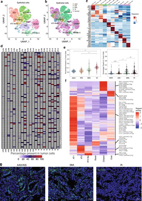 Characterization Of Epithelial Cell Lineages Across Different Stages A