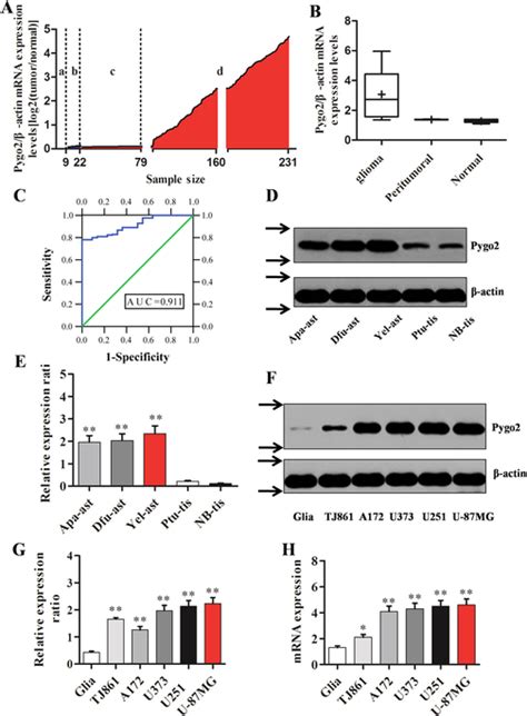 Expression Of Pygo2 In Primary Glioma Tissues And Cell Lines A